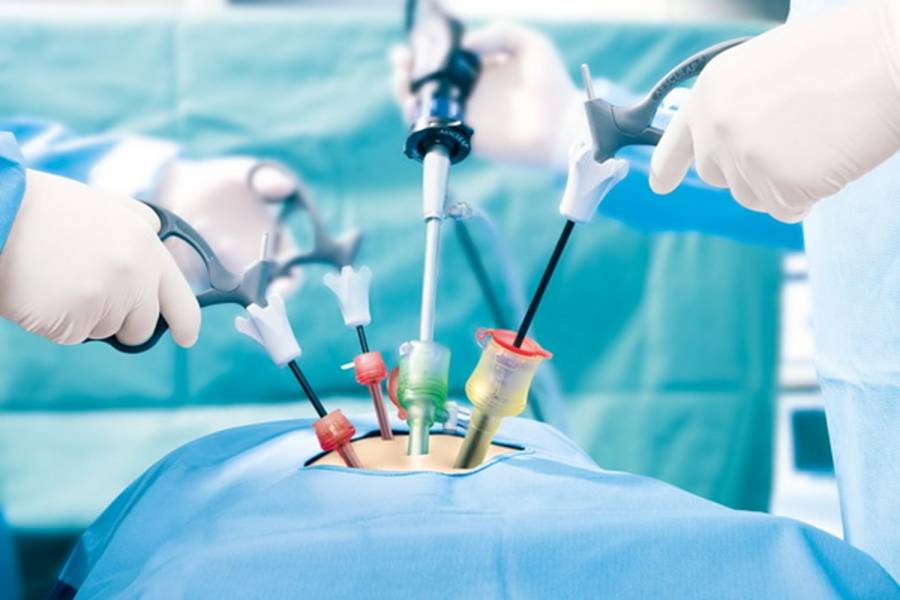 Laparoscopic Surgeon in Hyderabad | Laparoscopic Surgery in Secunderabad | Dr. N. S. Babu