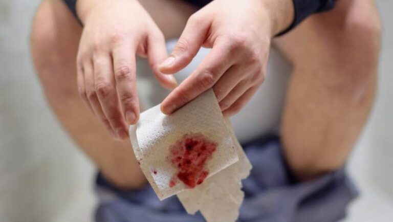 Reasons In Blood Stool Causes, Concerns, And Prevention