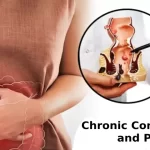 Illustration depicting strategies for managing chronic constipation and piles