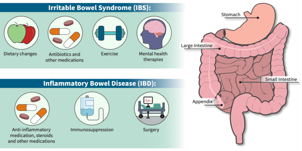 Illustration depicting the differences between IBD and IBS symptoms and treatments.