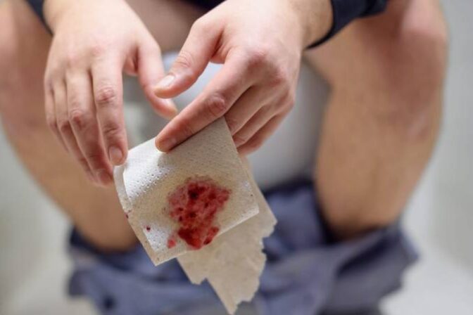 Blood in stool warning signs and rectal bleeding explained by specialist in Hyderabad