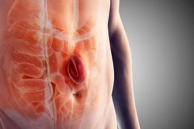 Is hernia curable without surgery – expert explanation by Dr. N. Subrahmaneswara Babu at Hills Gastro & Onco Care Hyderabad