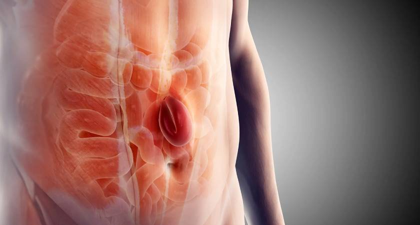 Is hernia curable without surgery – expert explanation by Dr. N. Subrahmaneswara Babu at Hills Gastro & Onco Care Hyderabad