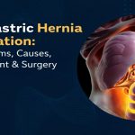 Epigastric Hernia Operation showing bulging upper stomach and surgical repair of epigastric hernia