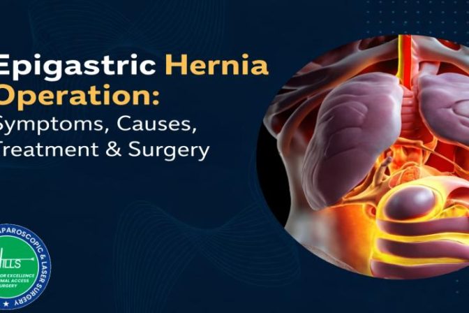 Epigastric Hernia Operation showing bulging upper stomach and surgical repair of epigastric hernia