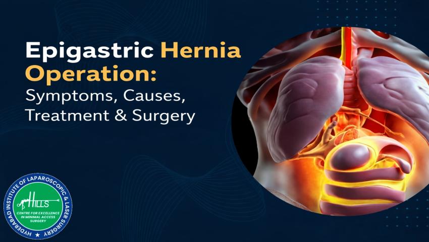 Epigastric Hernia Operation showing bulging upper stomach and surgical repair of epigastric hernia